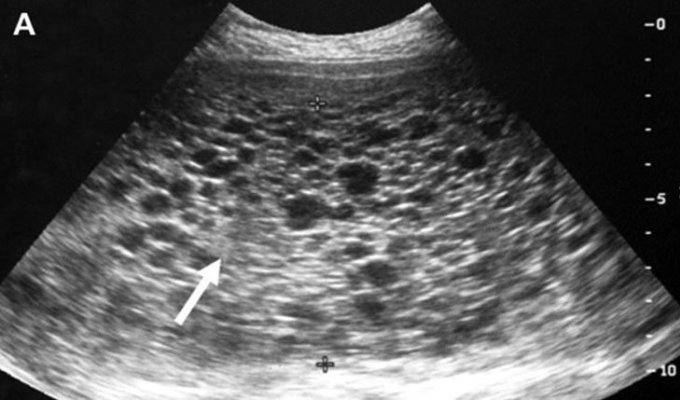Hình ảnh siêu âm của bệnh nhân đang mang thai.  Ảnh: Bệnh viện Phụ sản Hà Nội
